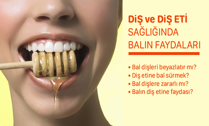 Doğru ve Yanlış. Bal Dişleriniz ve Diş Etiniz İçin Faydalı mı Zararlı Mı